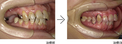 むし歯・歯周病・入れ歯 / 50代女性の画像